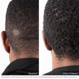 Biostim™ Scalp Serum