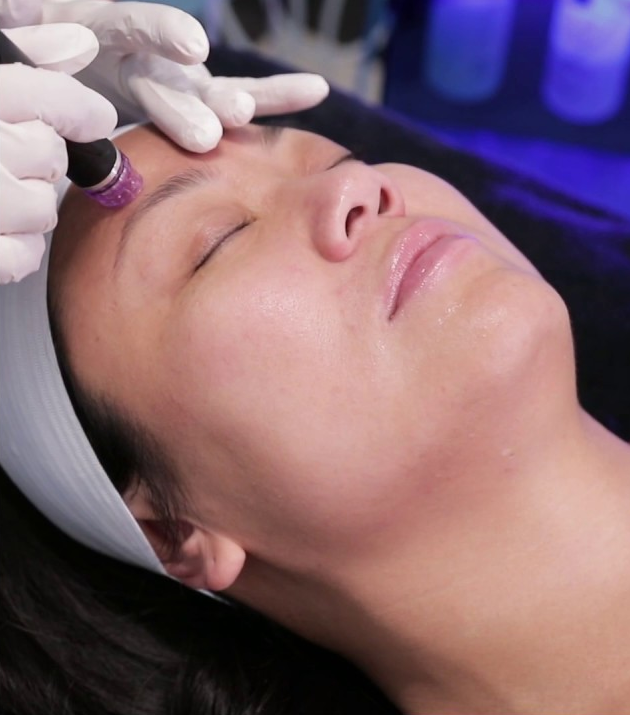 HydraPeel